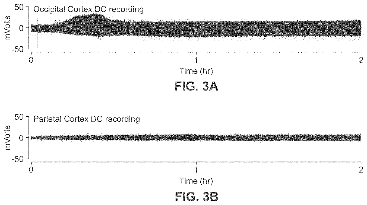 Methods for treating and for inhibiting progression of seizures