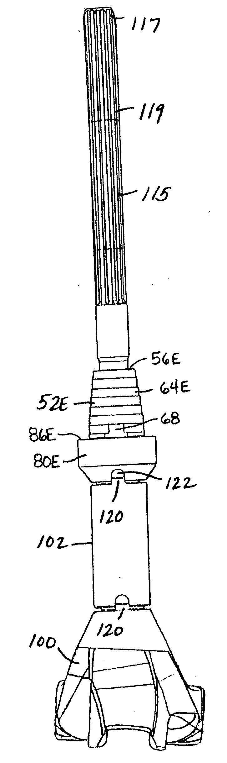Modular implant system and method with diaphyseal implant
