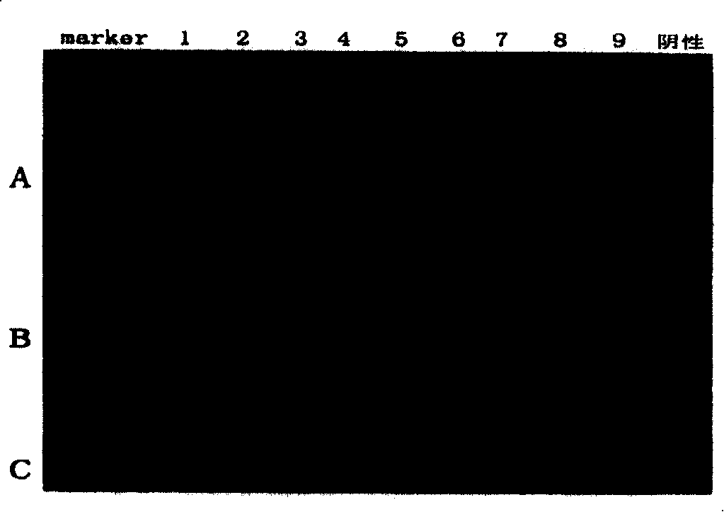 Method of detecting bioterror related pathogen bacteria and its special DNA chip