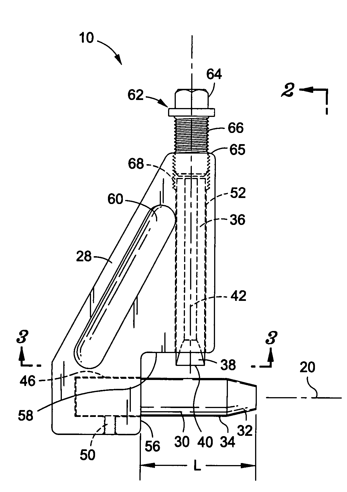 Compression sleeve splitter and removal tool
