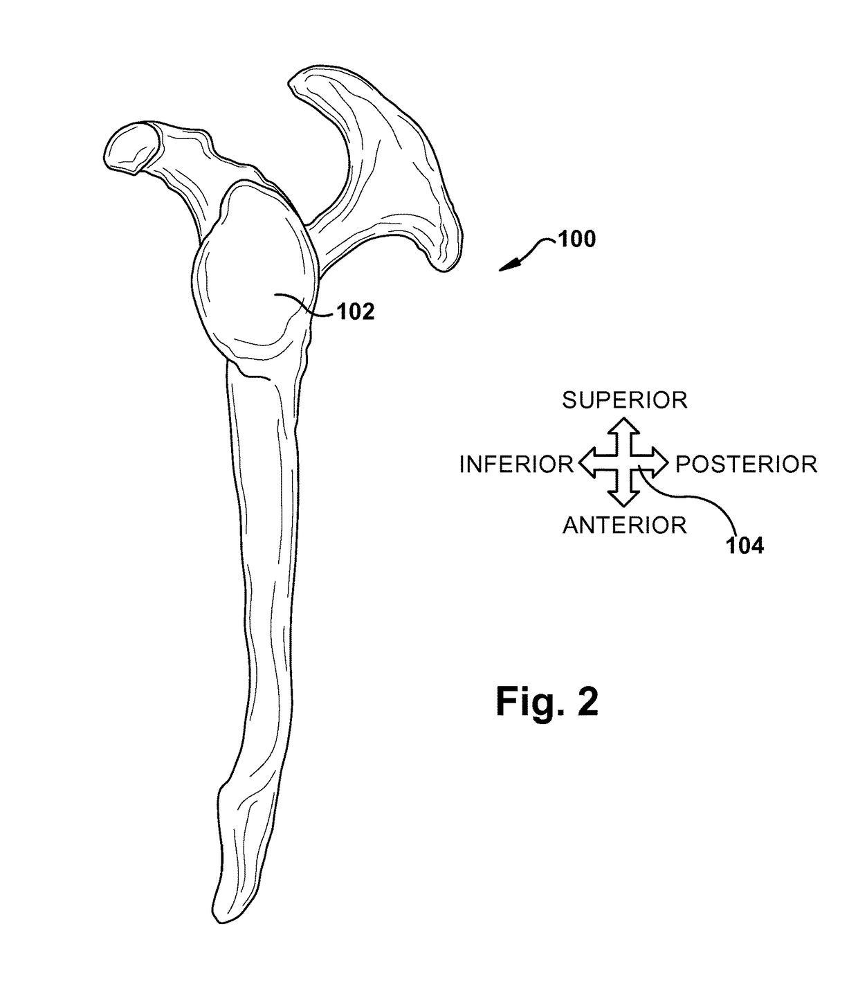 System and method for association of a guiding aid with a patient tissue