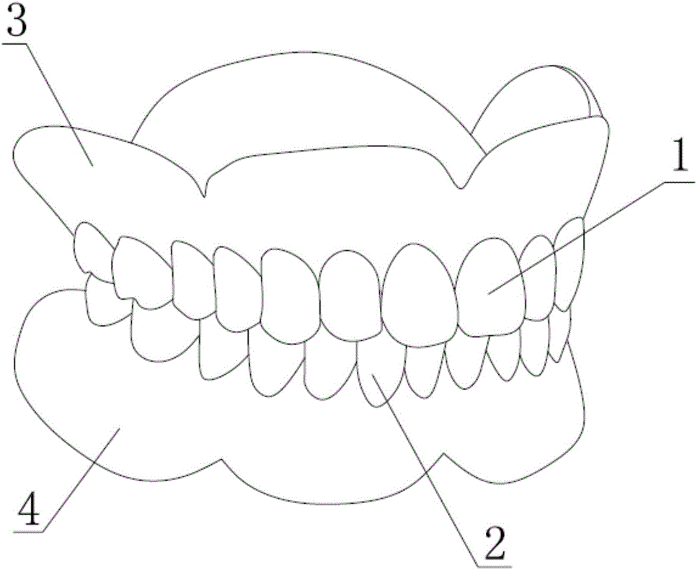 Detachable denture and preparation method thereof