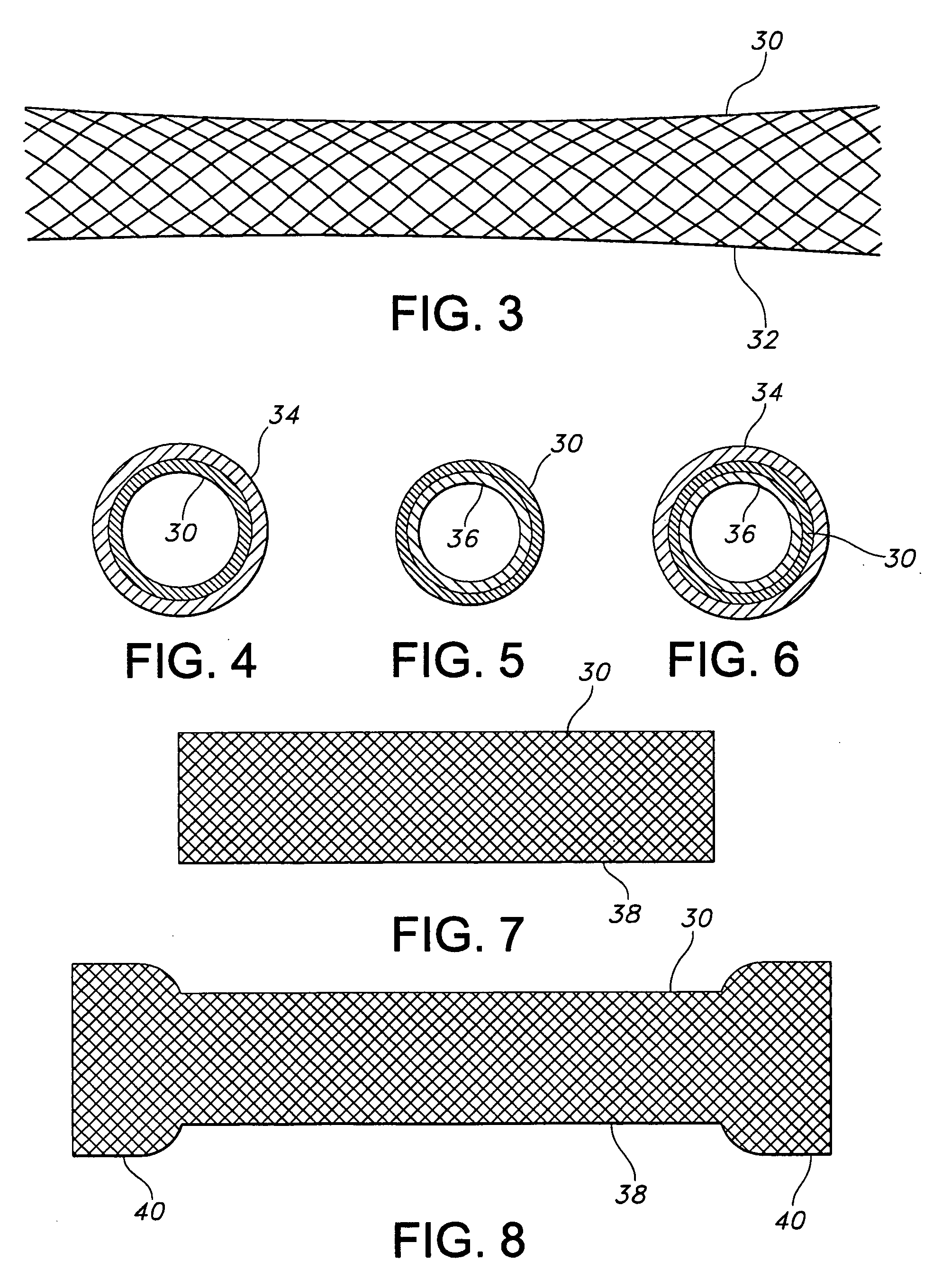 Apparatus and method for loading and delivering a stent