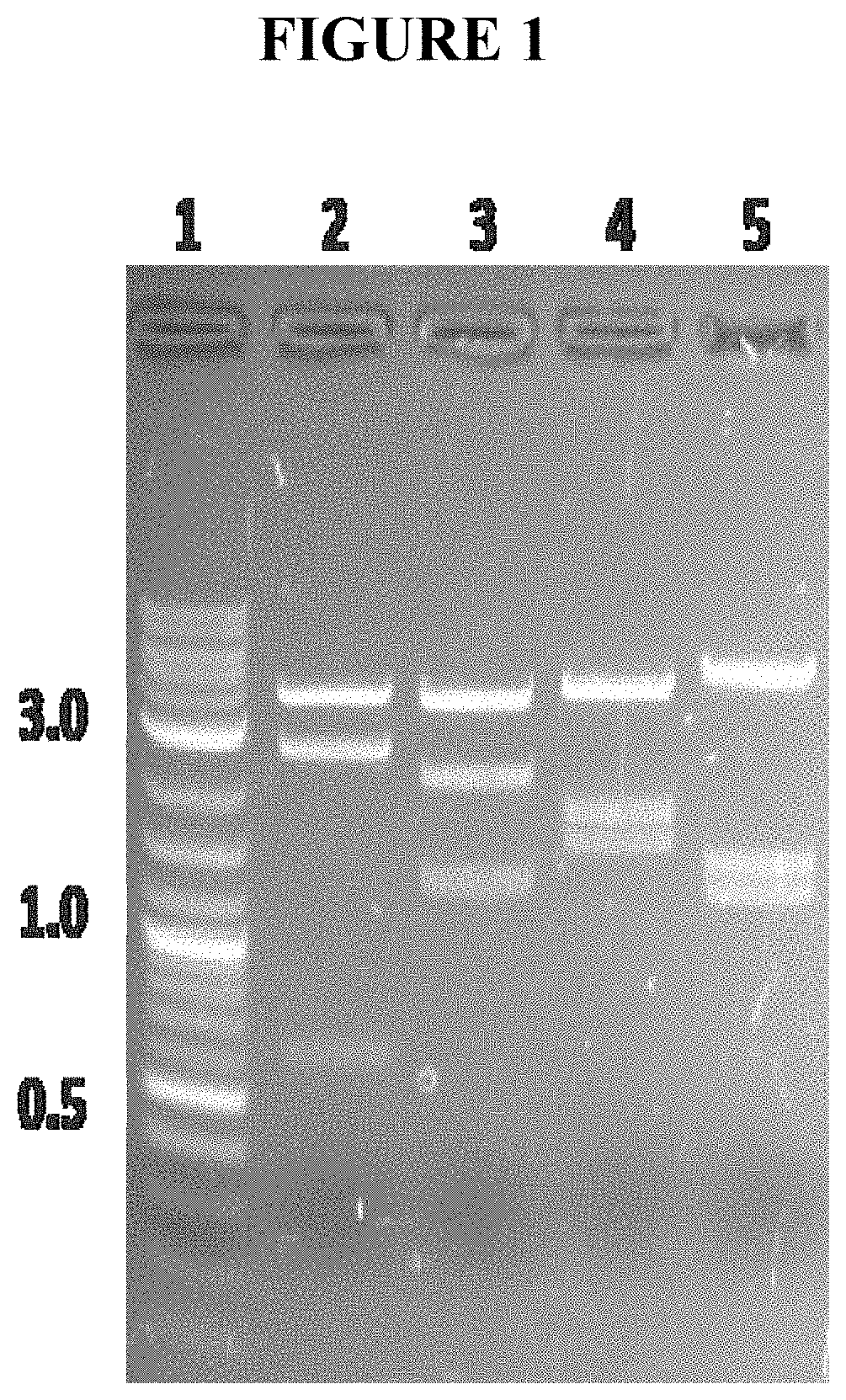 Codon optimized rpgrorf15 genes and uses thereof