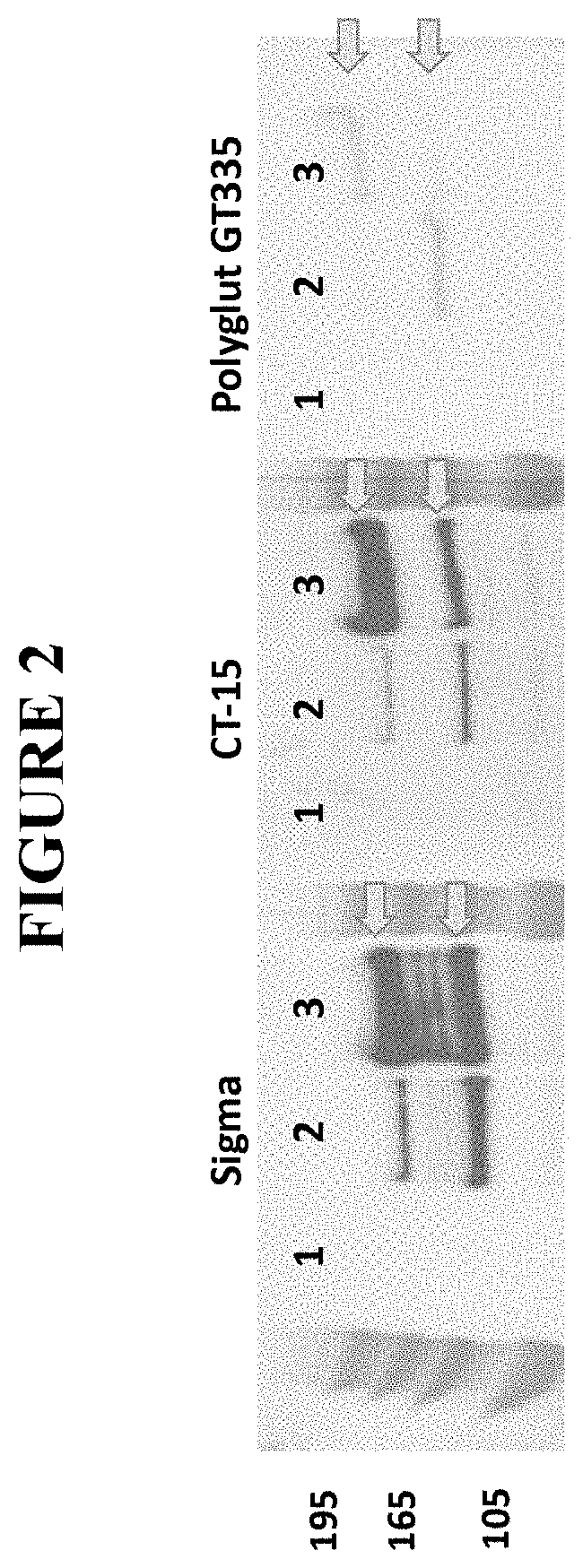 Codon optimized rpgrorf15 genes and uses thereof