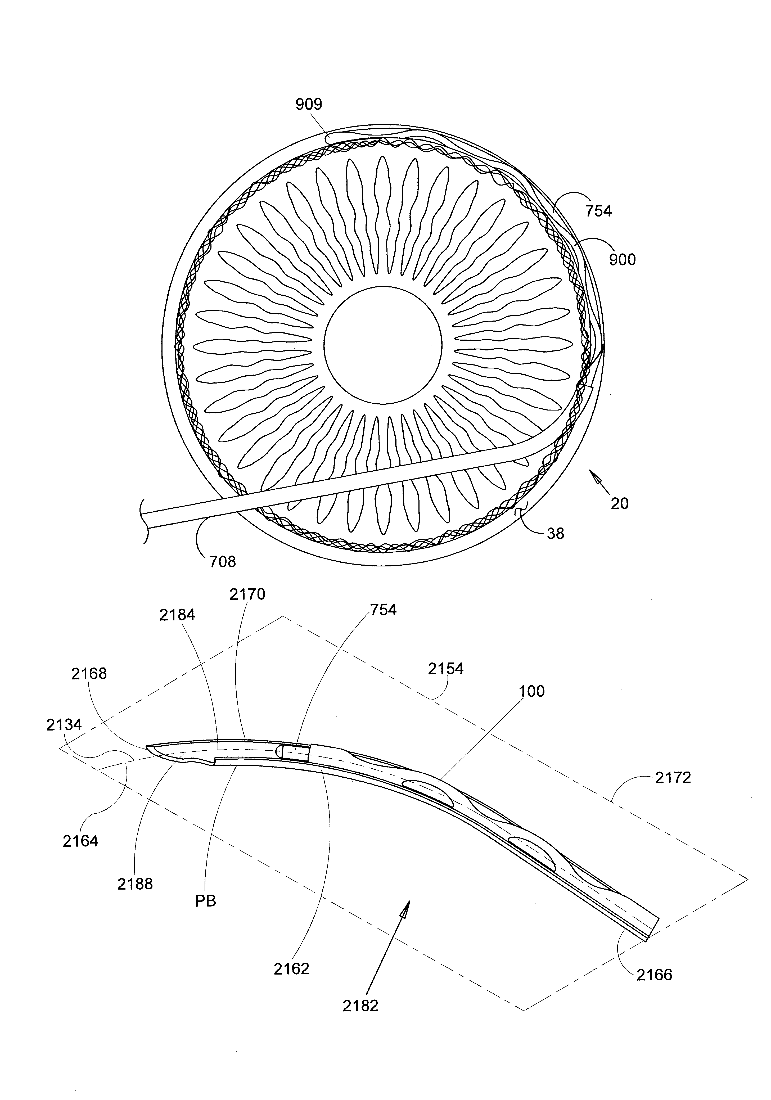 Methods and apparatus for delivering ocular implants into the eye