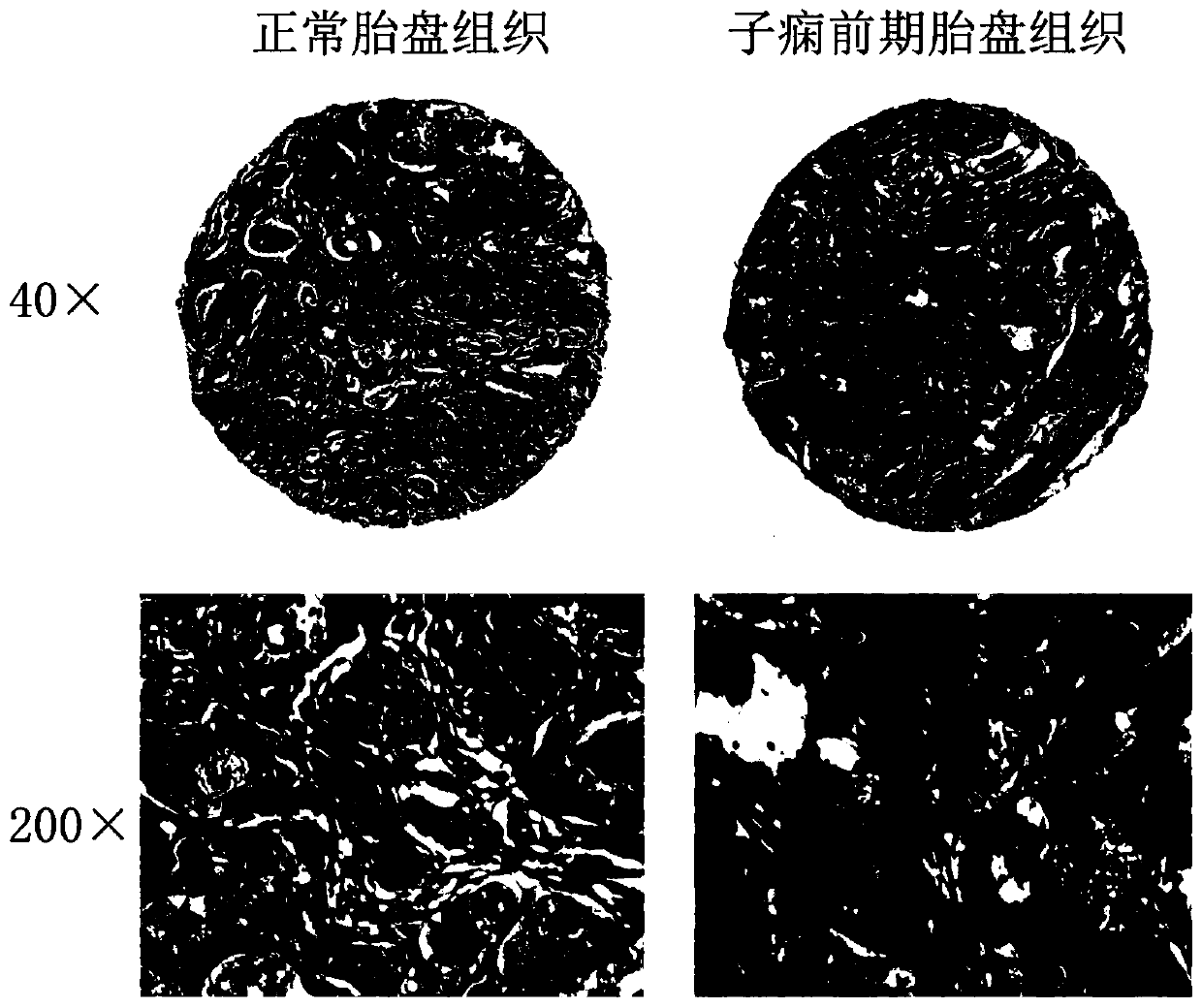 Application of labeling reagent of long-chain fatty acid coenzyme A ligase 1 in preeclampsia diagnosis or prediction