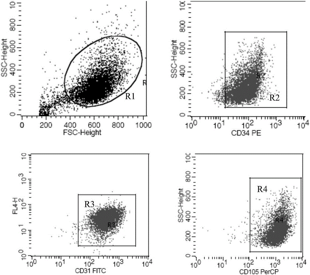 Separation and in vitro amplification method of human vein endothelial cells