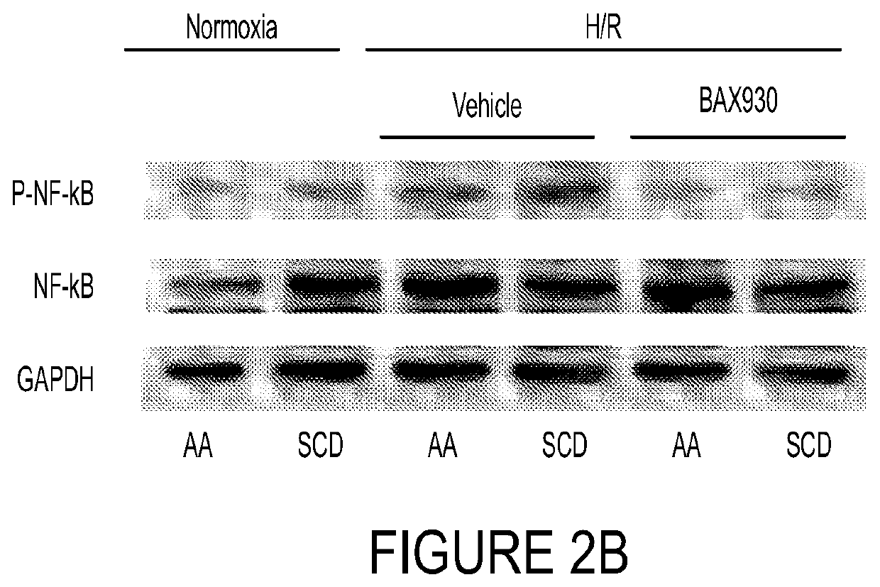 Use of adamts13 for treating, ameliorating and/or preventing vaso-occlusive crisis in sickle cell disease, acute lung injury and/or acute respiratory distress syndrome