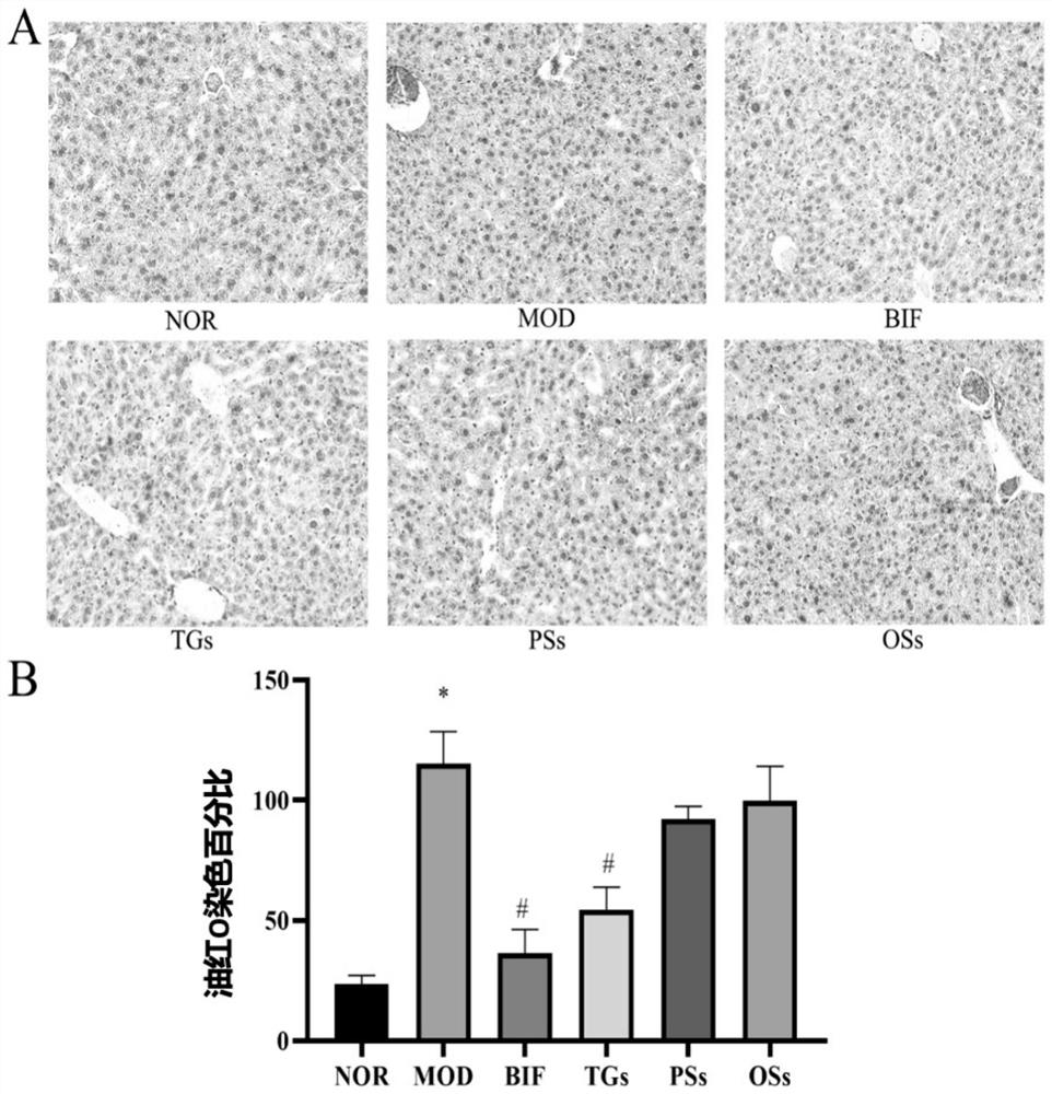 Application of cistanche total glycosides and echinacoside in preparation of medicines for preventing and treating alcoholic liver injury with intestinal injury