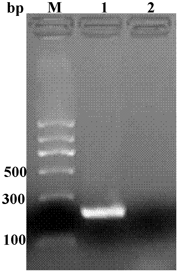 Schistosoma japonicum calcium-binding EF-hand domain containing protein (SjEFCAB) recombinant antigen protein and preparation method and application thereof