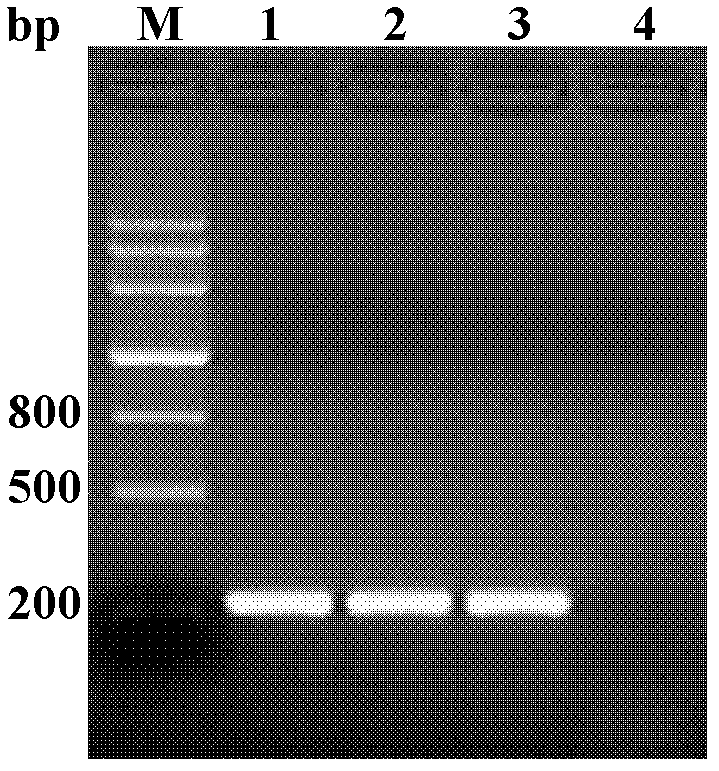 Schistosoma japonicum calcium-binding EF-hand domain containing protein (SjEFCAB) recombinant antigen protein and preparation method and application thereof