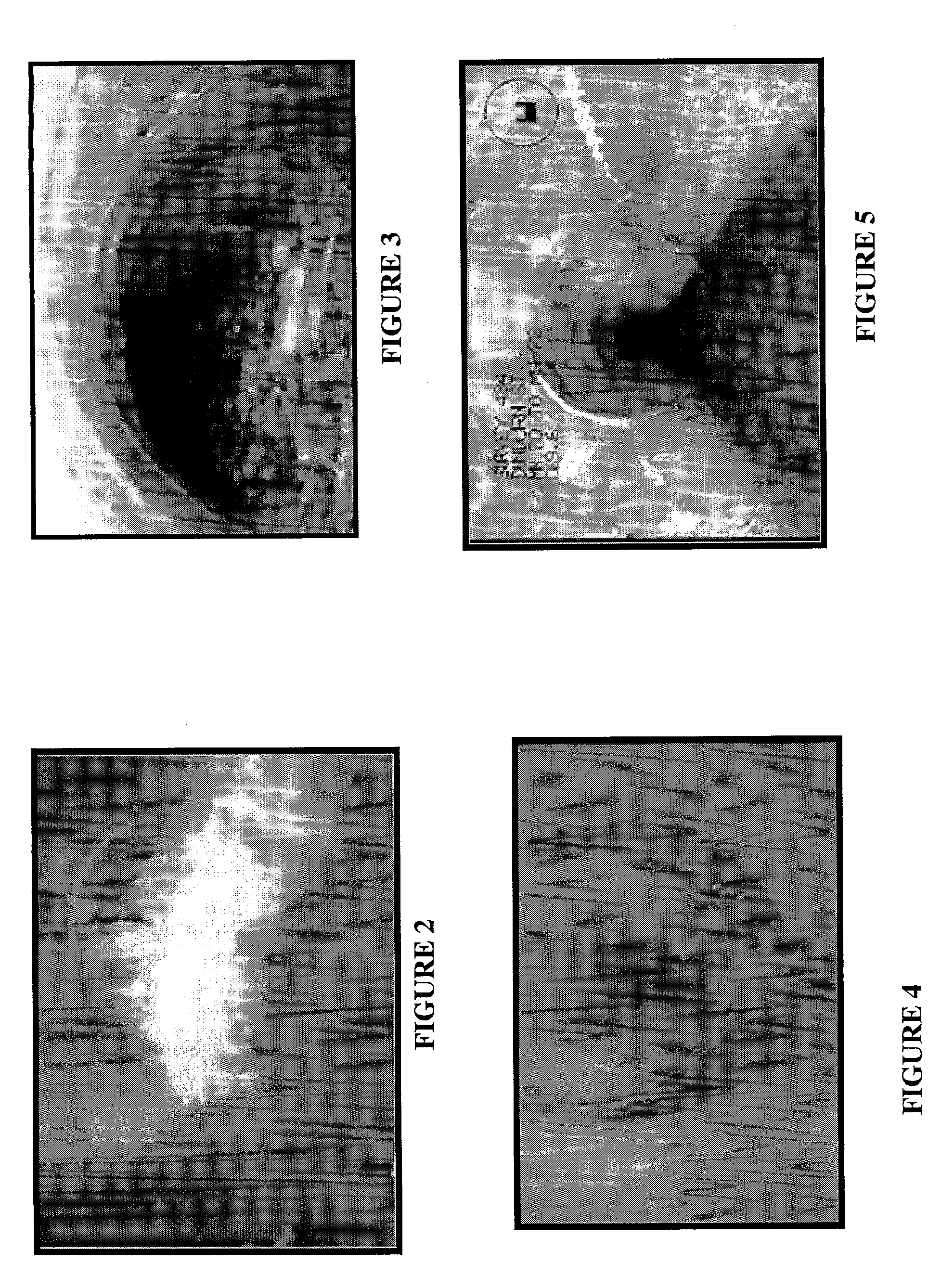 Method and apparatus for the automated detection and classification of defects in sewer pipes