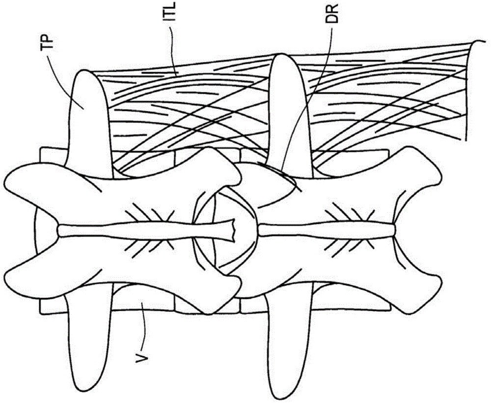 Apparatus and methods for anchoring electrode leads adjacent to nervous tissue