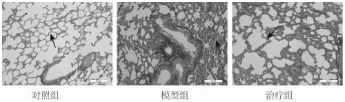 Application of CoQ10 in silicosis fibrosis resistance