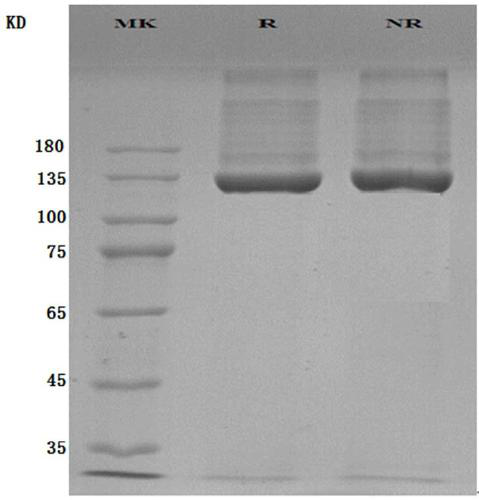 Nucleic acid composition for detecting novel coronavirus COVID-19 and application