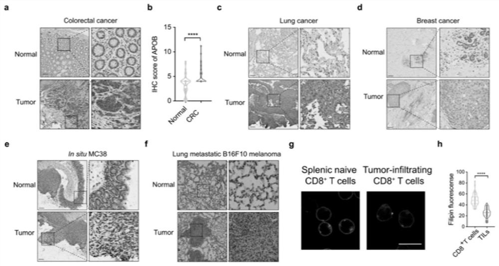 Application of LDLR (Low-Density Lipoprotein Receptor) in tumor immunotherapy and enhancement of immune effect of immune cells