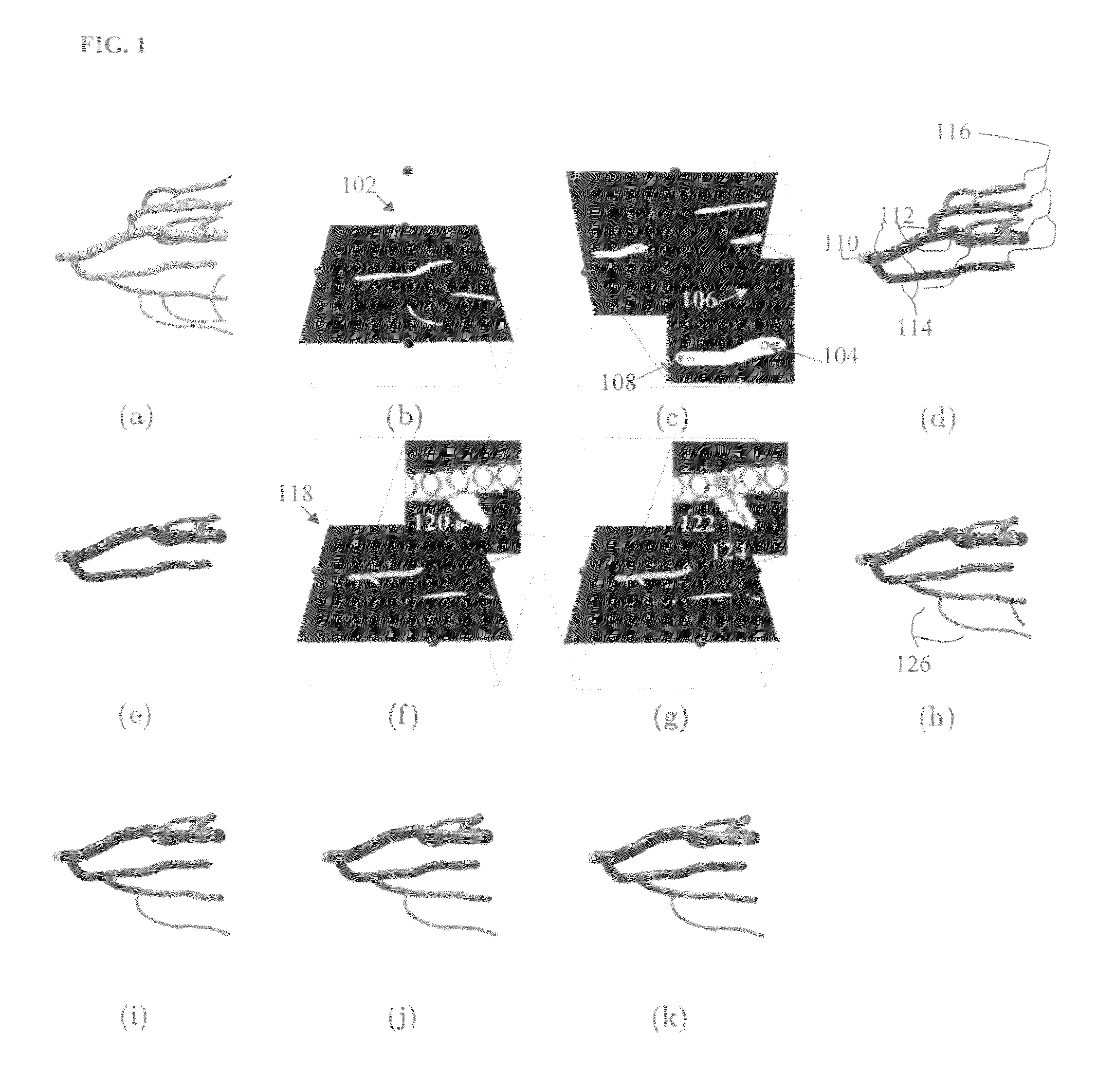 Method and system for segmentation of tubular structures in 3D images