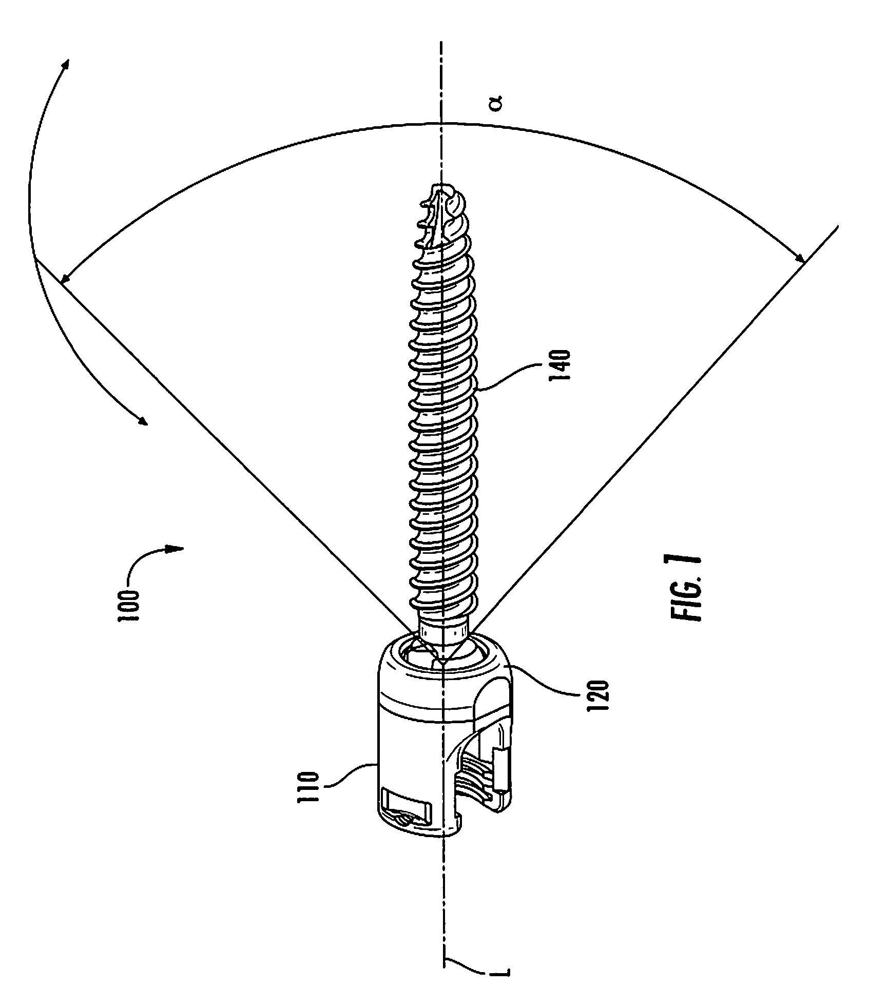 Spinal fixation system