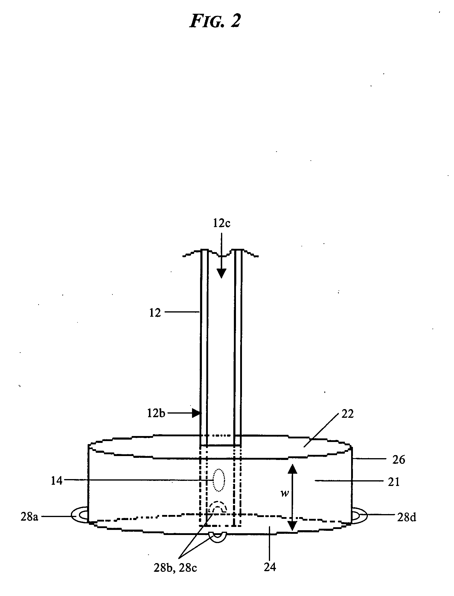 Brachytherapy apparatus and method for treating a target tissue through an external surface of the tissue