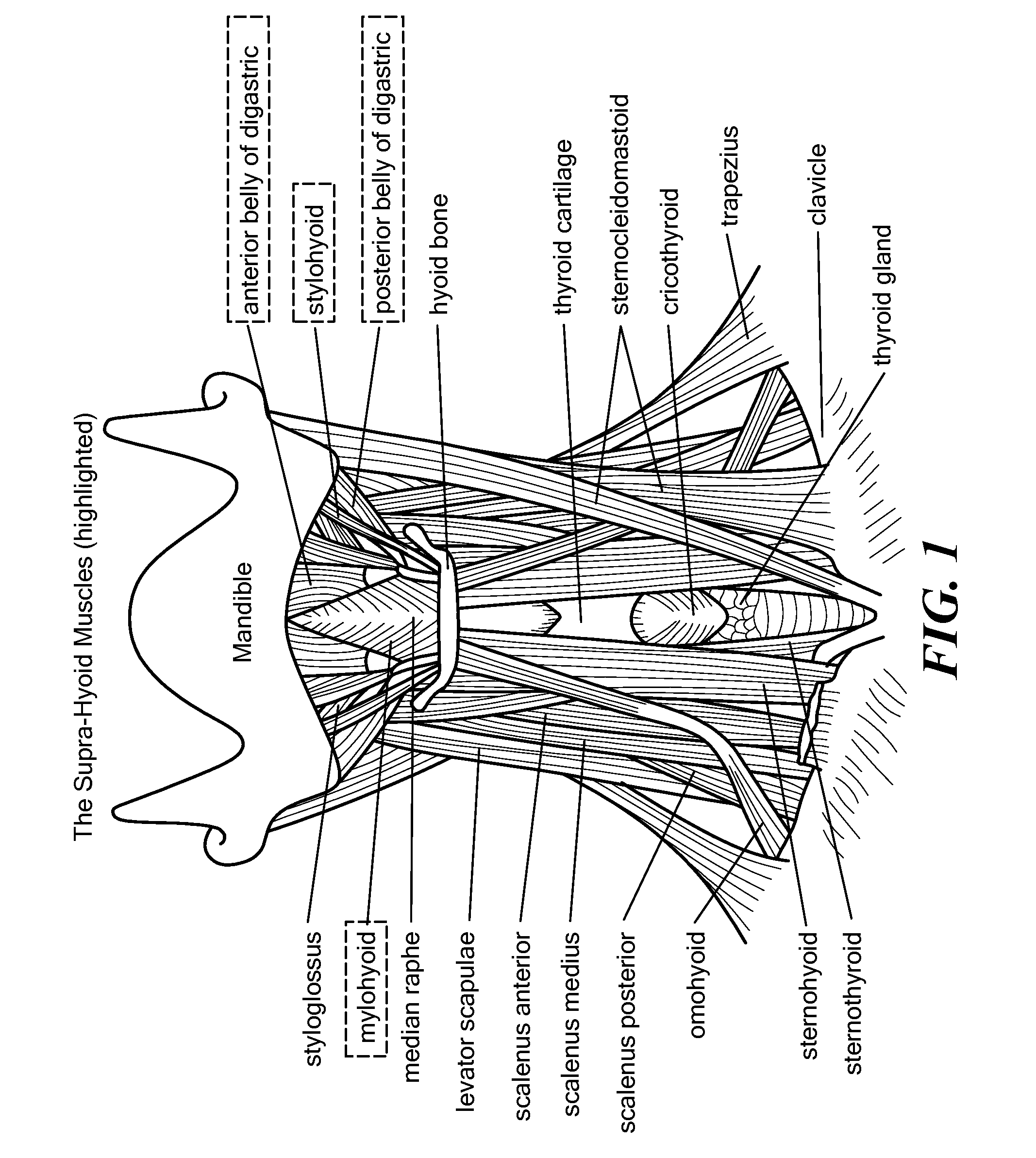 Method for modifying larynx position by trans-positioning muscle and electrode stimulation