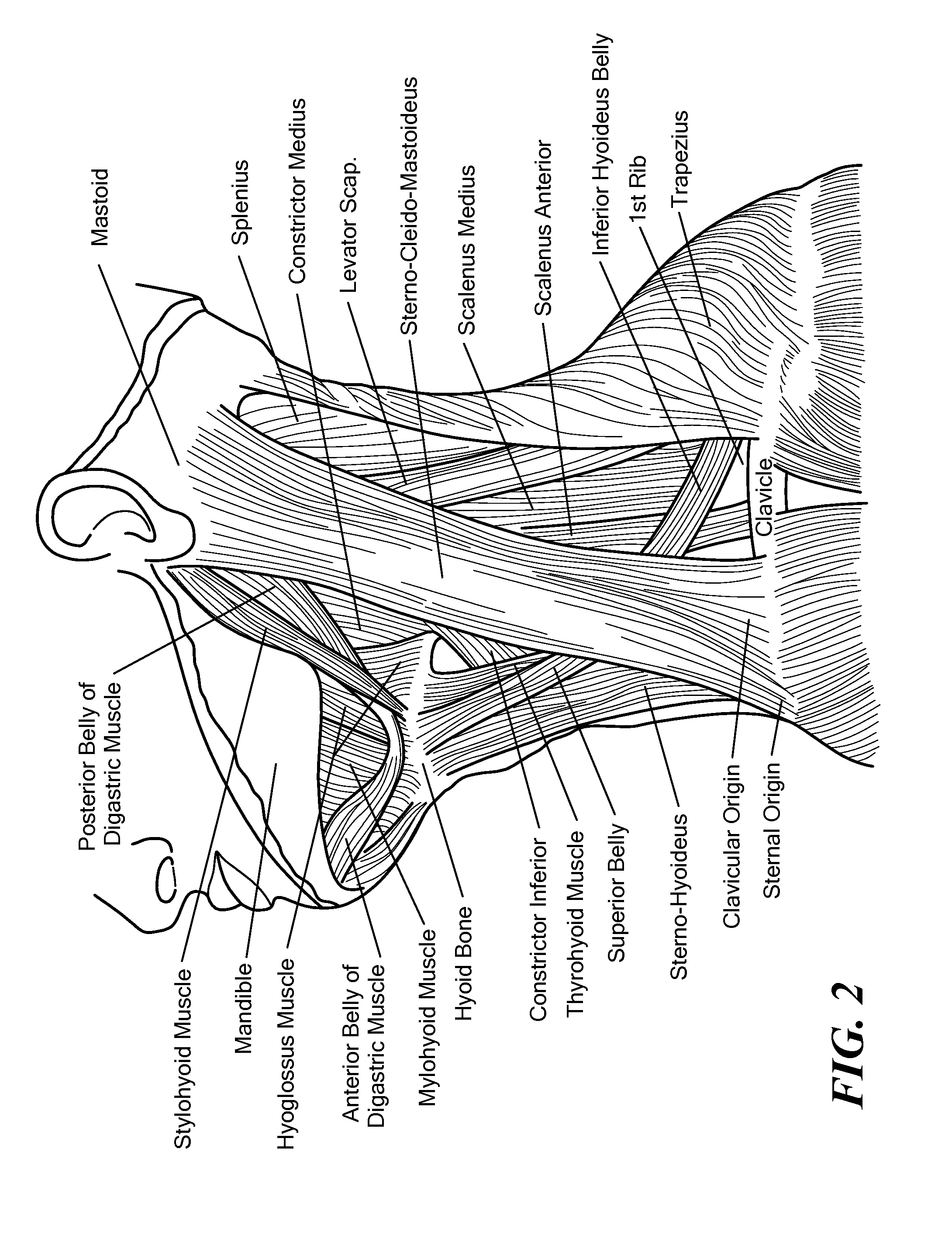 Method for modifying larynx position by trans-positioning muscle and electrode stimulation