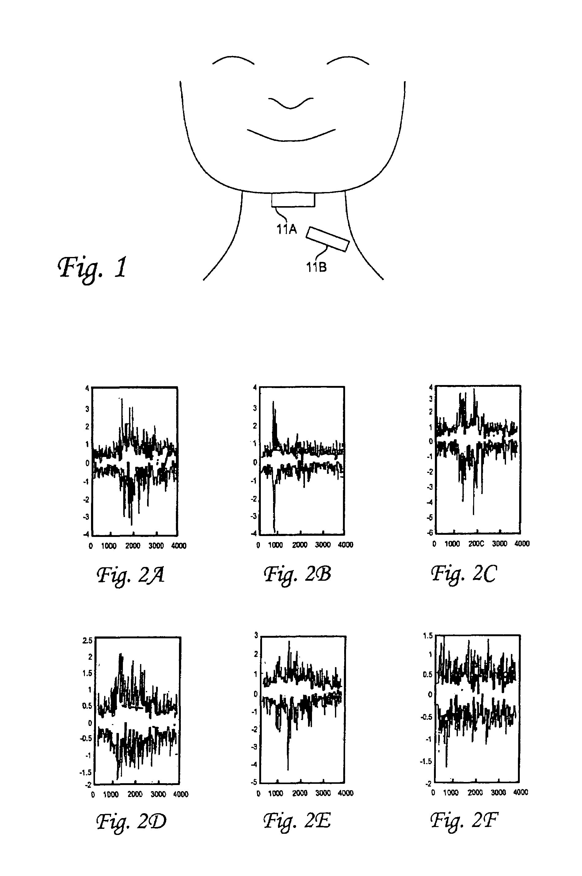 Applications of sub-audible speech recognition based upon electromyographic signals