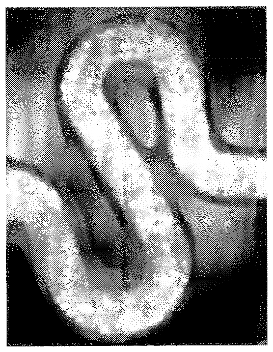 Drug-eluting stent