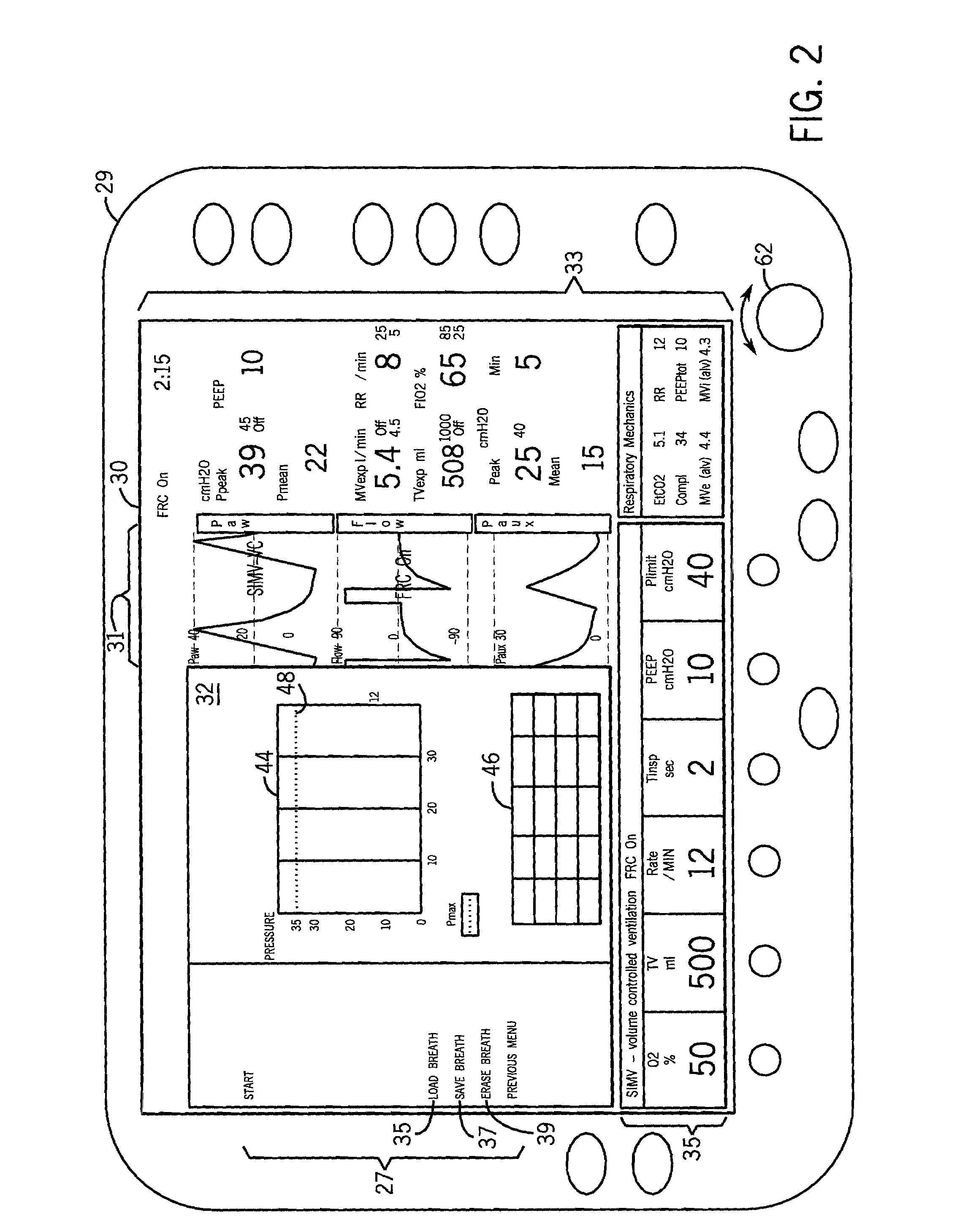 Device and method for graphical mechanical ventilator setup and control