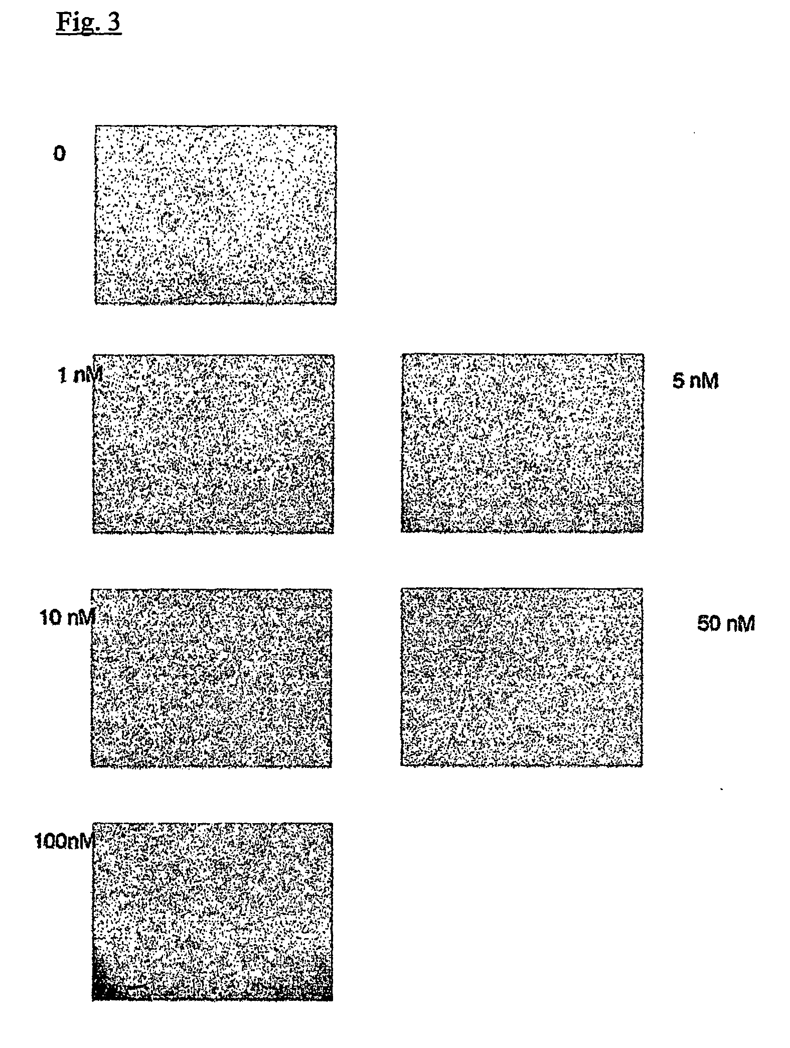 Pharmaceutical compositions for inhibiting metal ion dependent enzymatic activity and methods for the use thereof