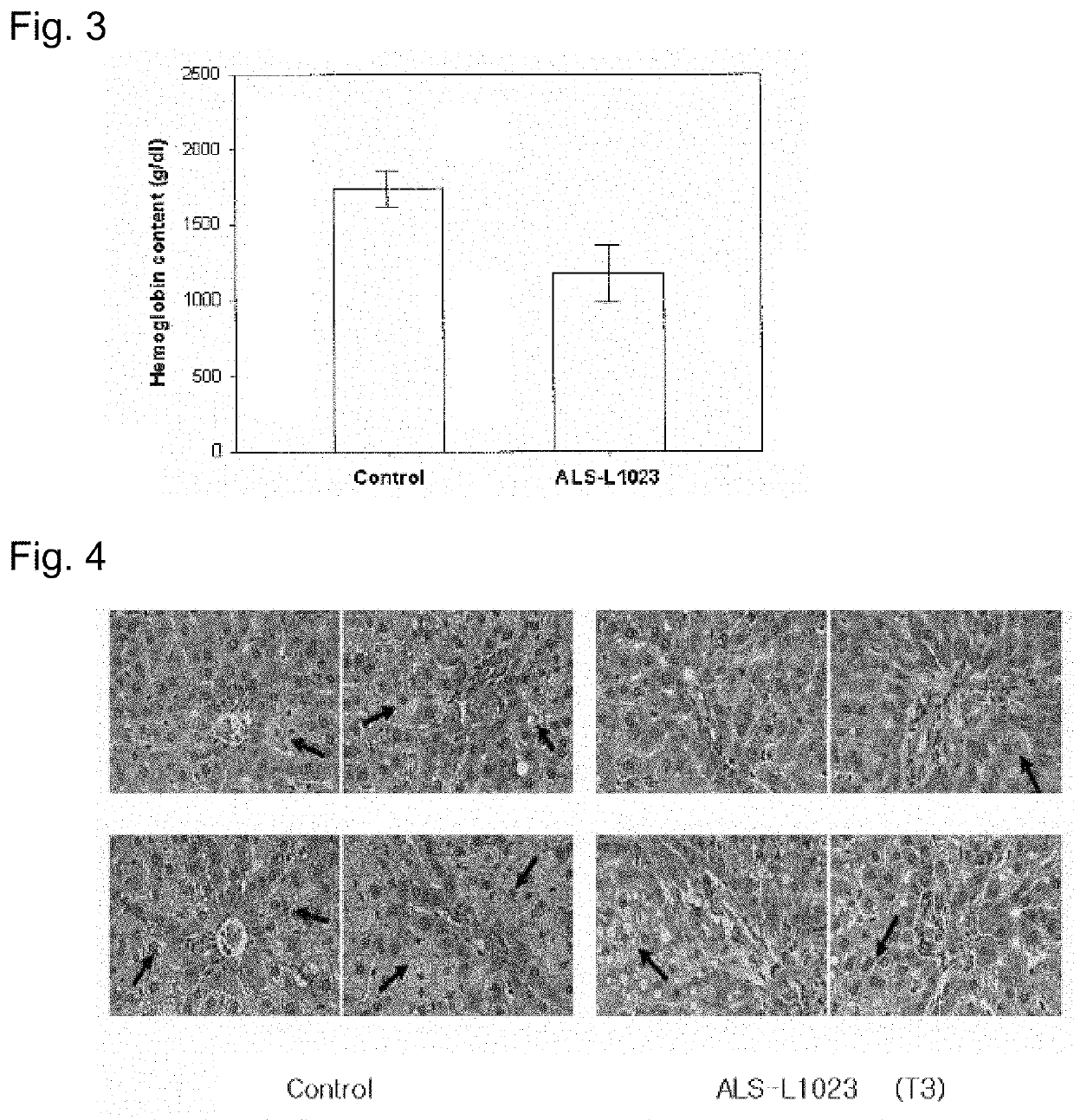 Fraction of melissa leaf extract having angiogenesis and MMP inhibitory activities, and composition comprising the same