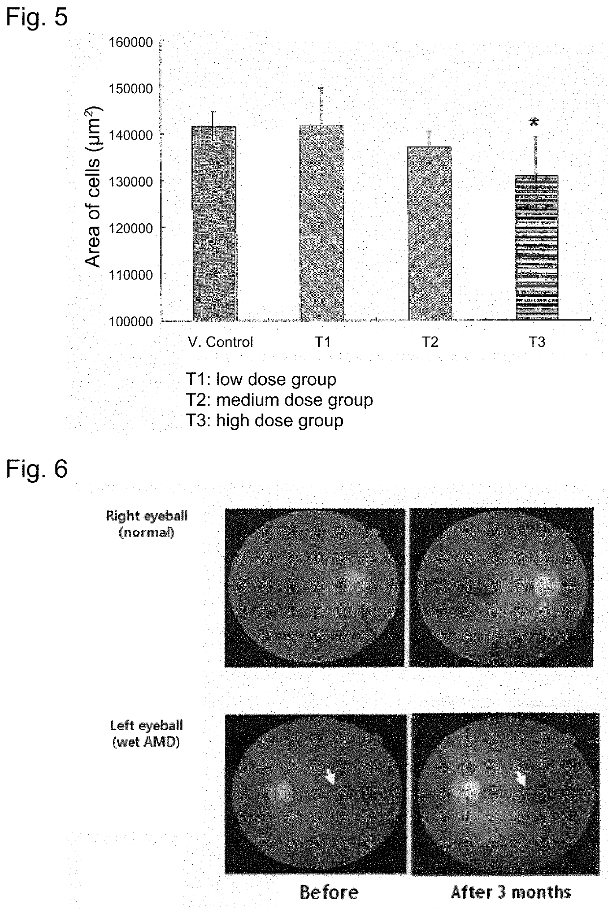 Fraction of melissa leaf extract having angiogenesis and MMP inhibitory activities, and composition comprising the same