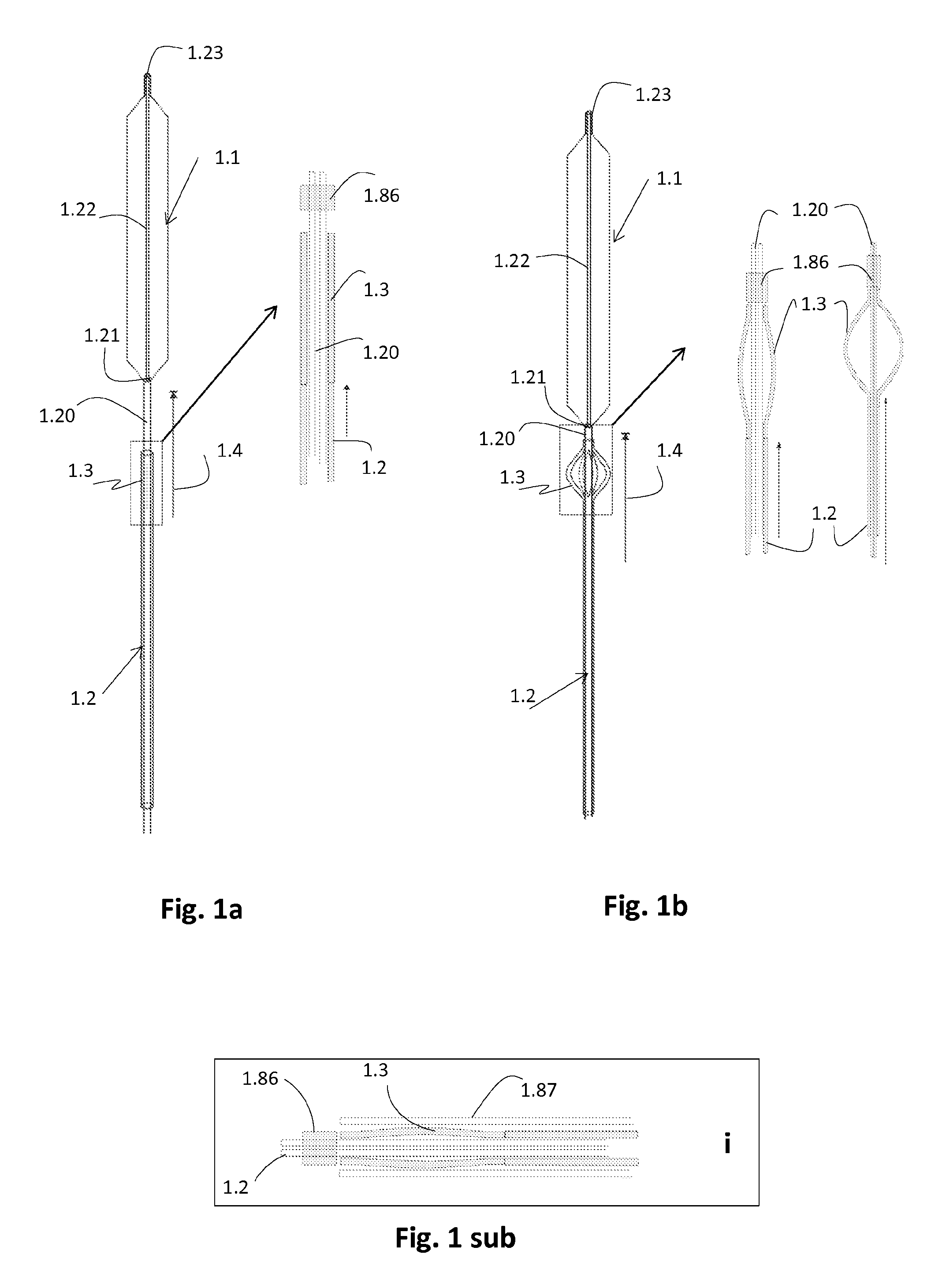 Intra-aortic balloon apparatus, assist devices and methods for improving flow, counterpulsation and haemodynamics