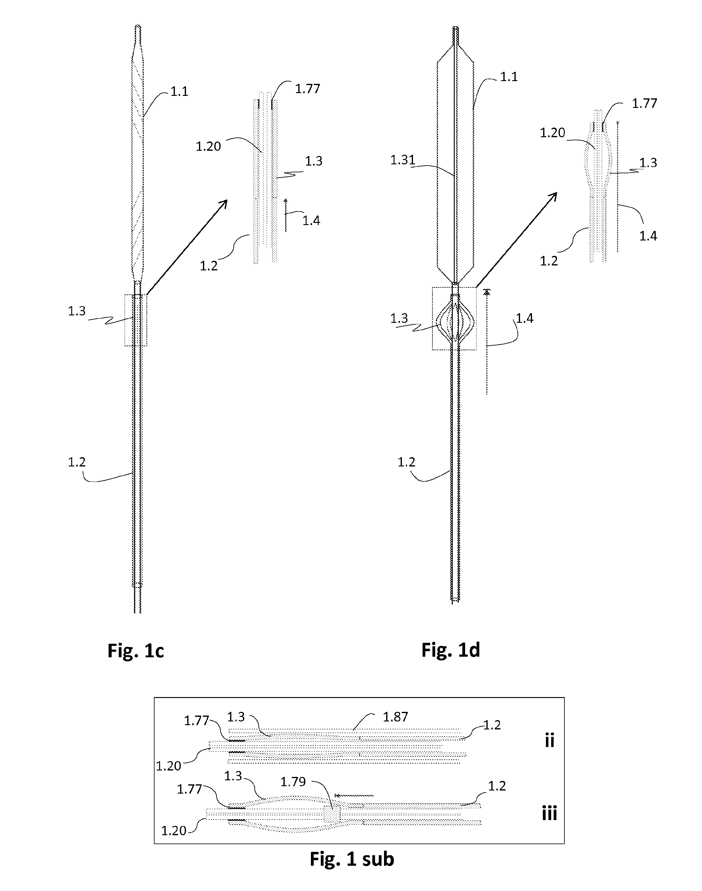 Intra-aortic balloon apparatus, assist devices and methods for improving flow, counterpulsation and haemodynamics