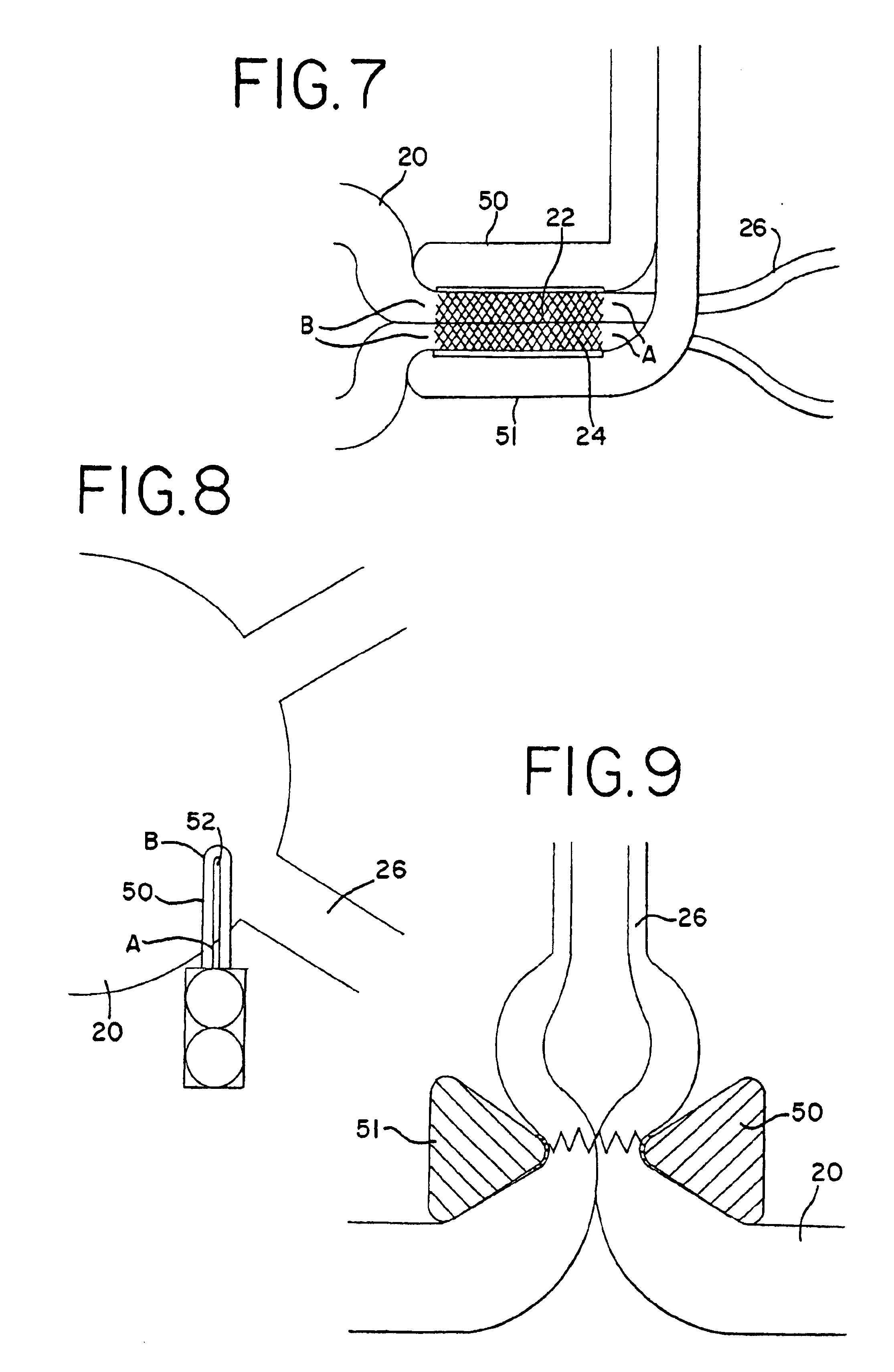 Transmural ablation device