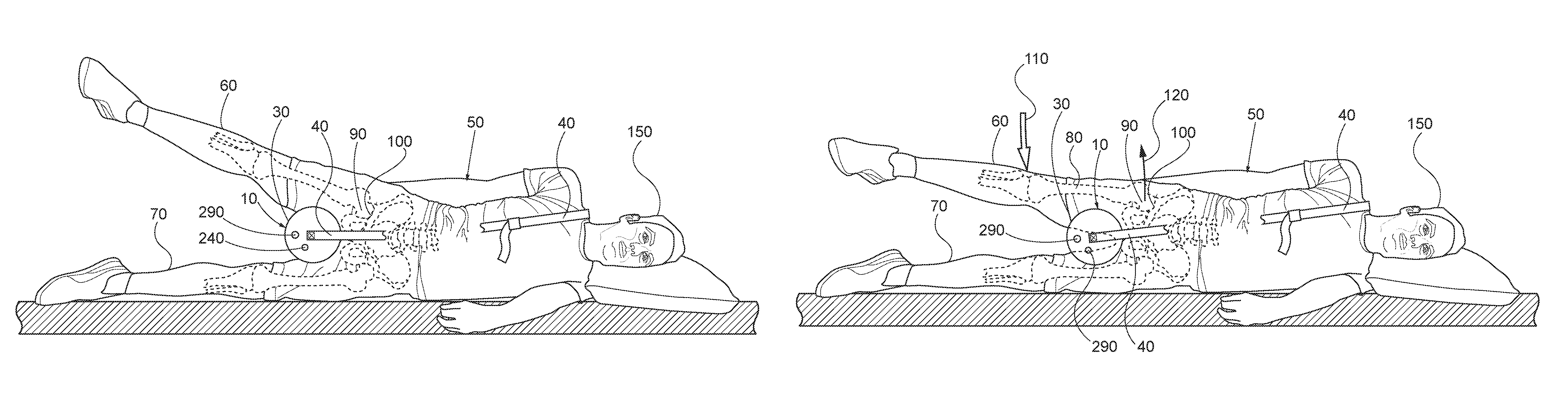 Devices for mobilizing the hip joint capsule and methods of using same