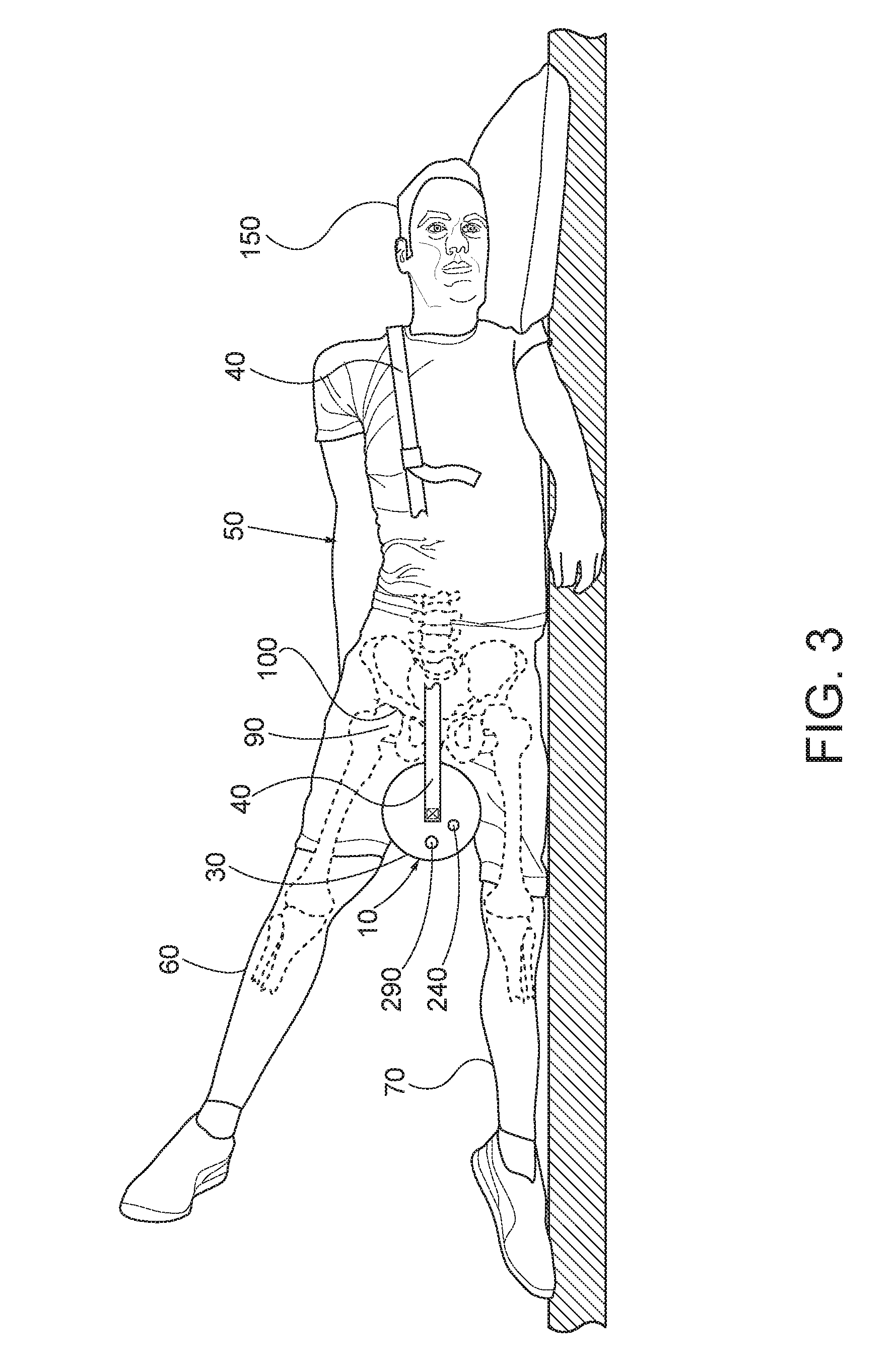 Devices for mobilizing the hip joint capsule and methods of using same