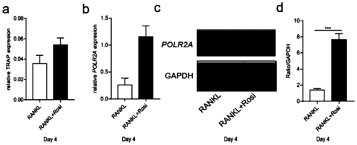 Application of POLR2A inhibitor in preparation of medicine