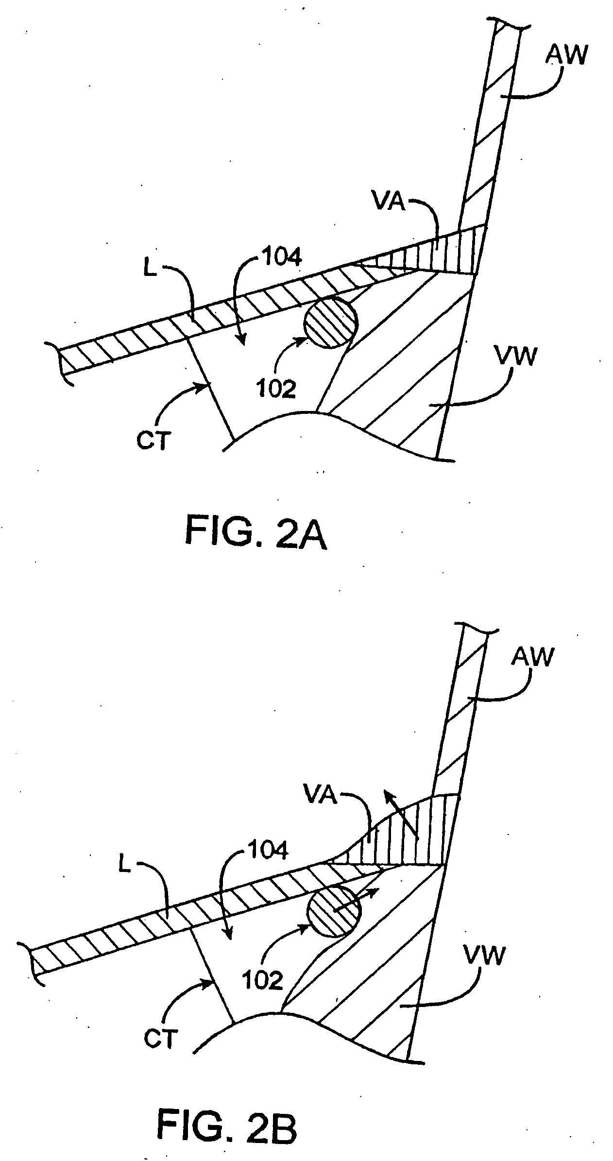 Methods and devices for termination