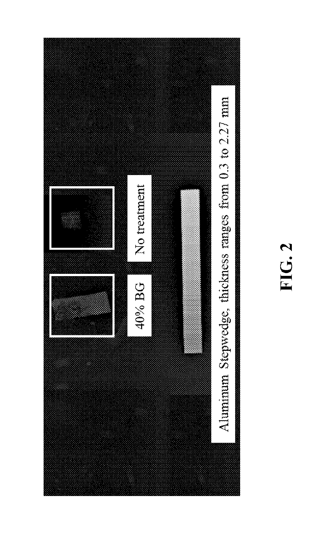 Bone Graft Substitute Containing a Temporary Contrast Agent and a Method of Generating Such and A Method of Use Thereof