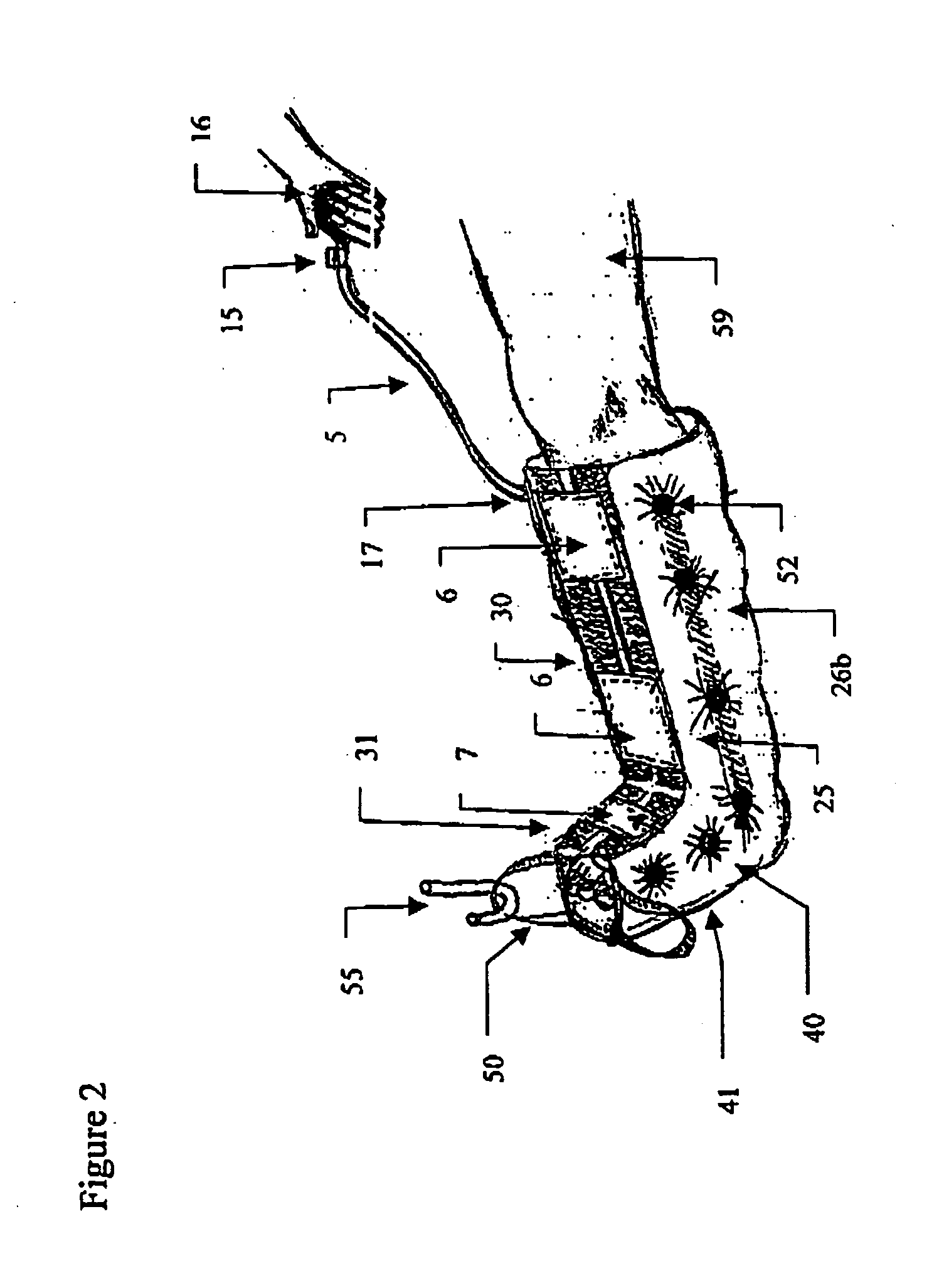 Immobilizing and supporting inflatable splint apparatus