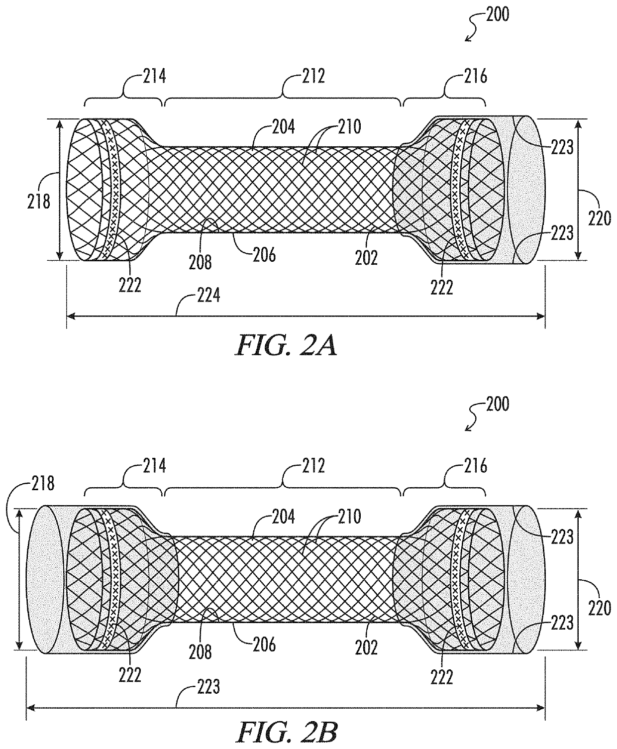 Stents with improved fixation