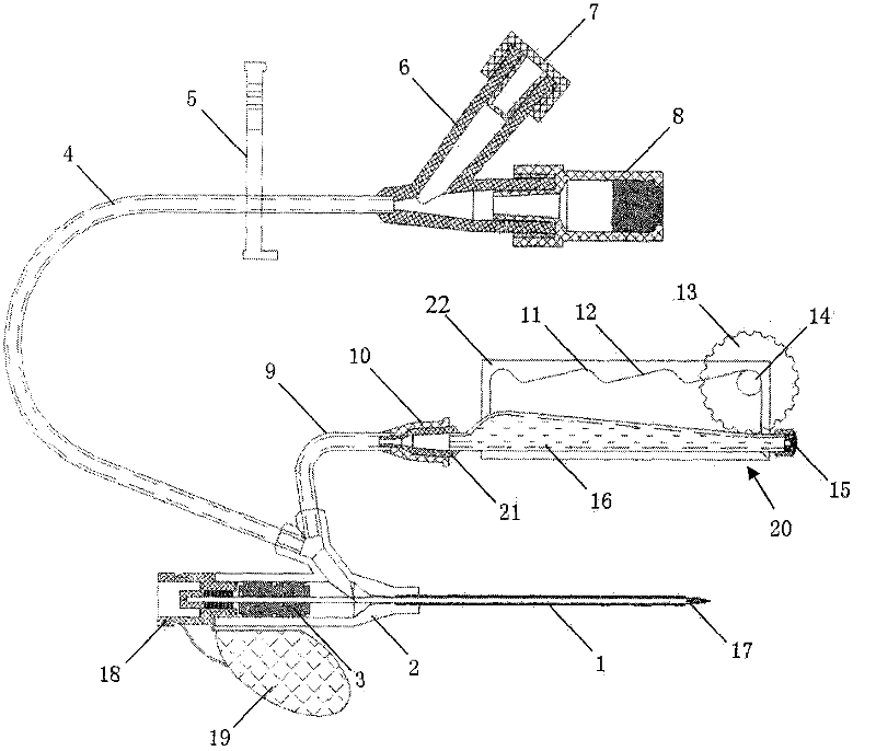 Venous indwelling needle with hirudin anticoagulation pipe-sealing device