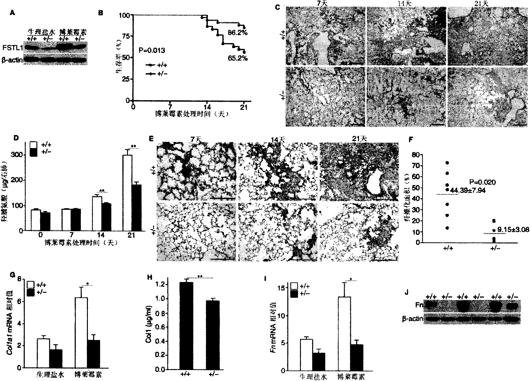 Monoclonal antibody of follistatin-like protein l and application thereof