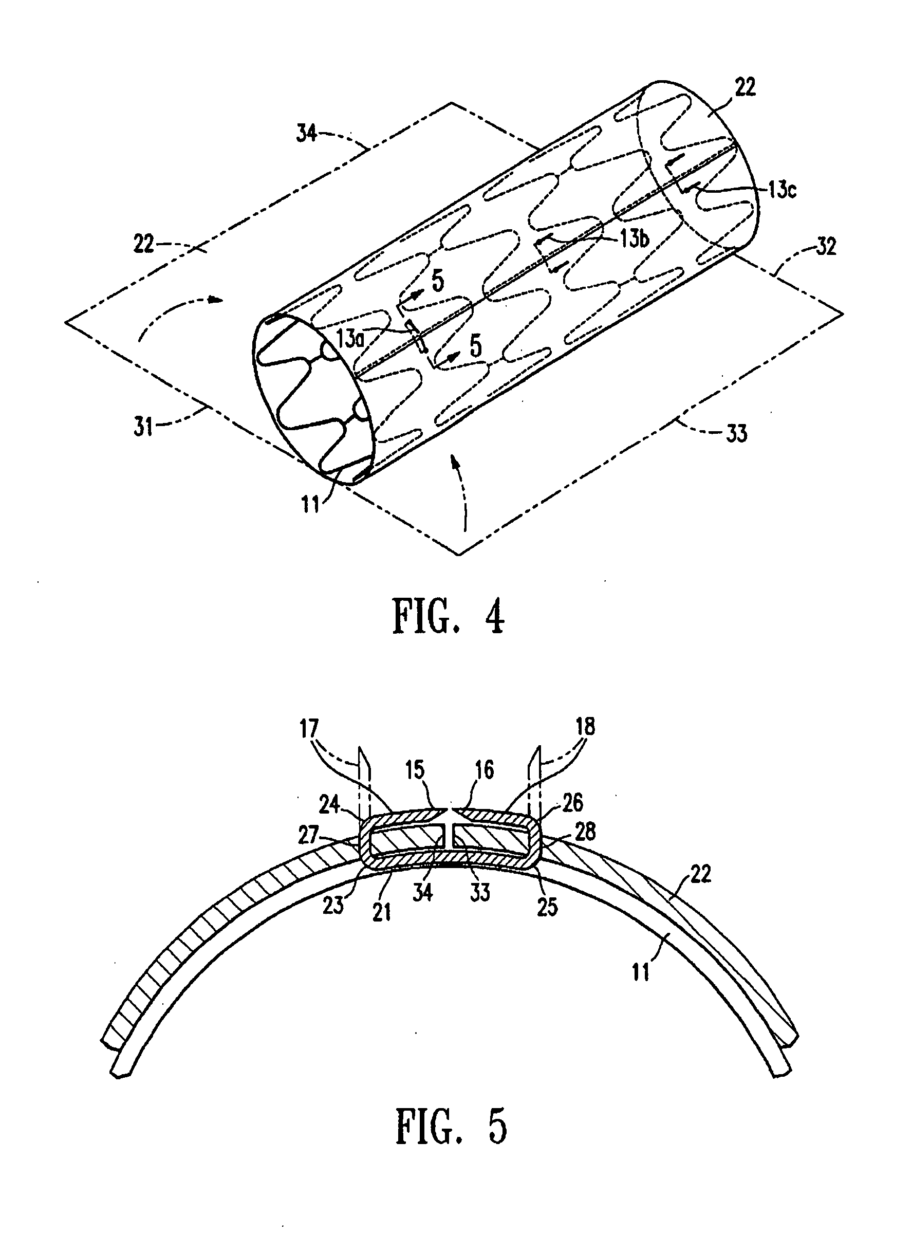 Stent with cover connectors