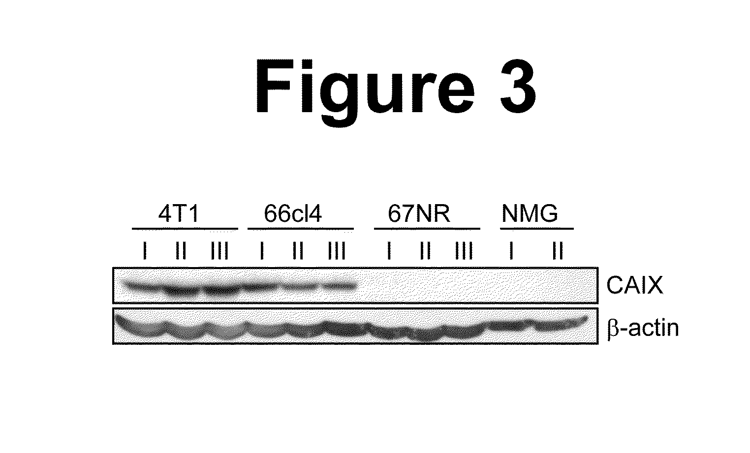 Novel sulfonamide compounds for inhibition of metastatic tumor growth