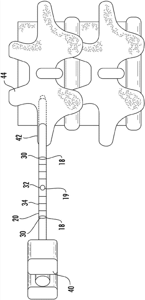 Trajectory guidance device and system for surgical instruments