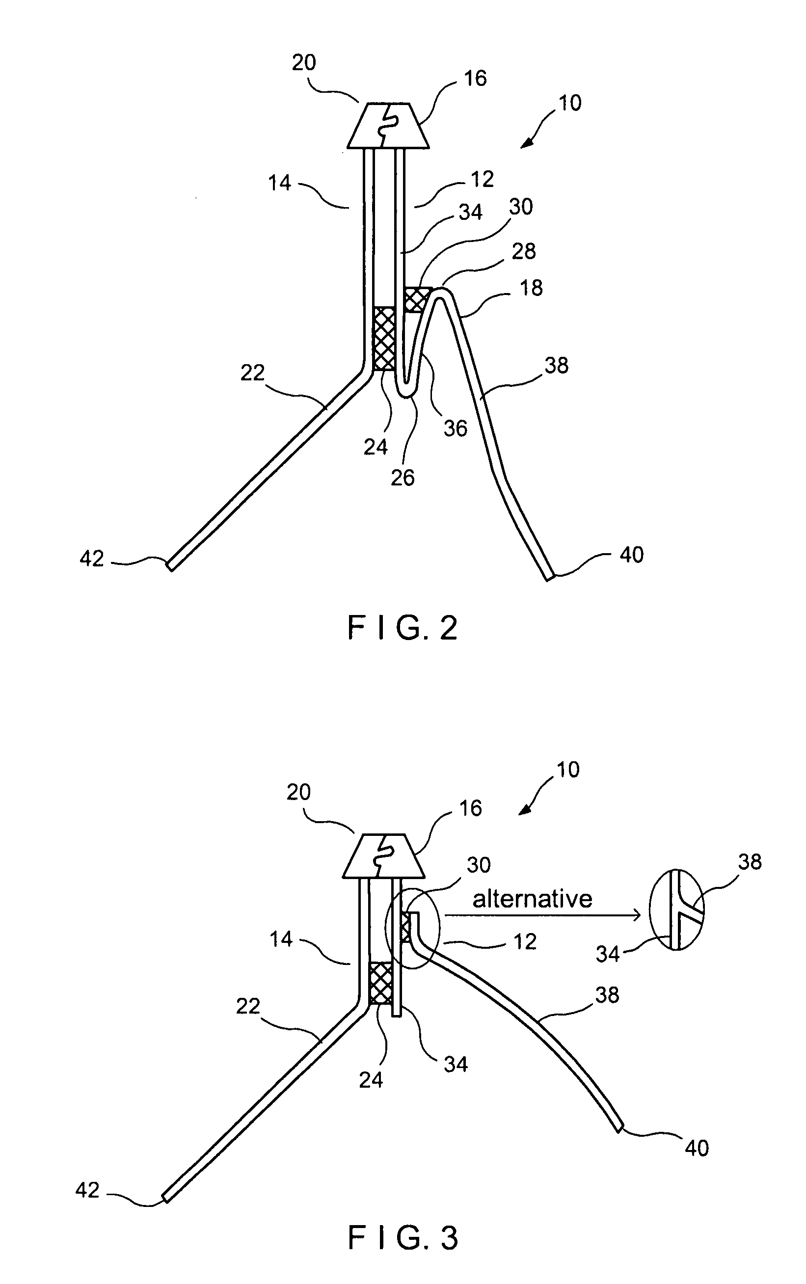 Method of producing high burst zipper assemblies for large reclosable packages