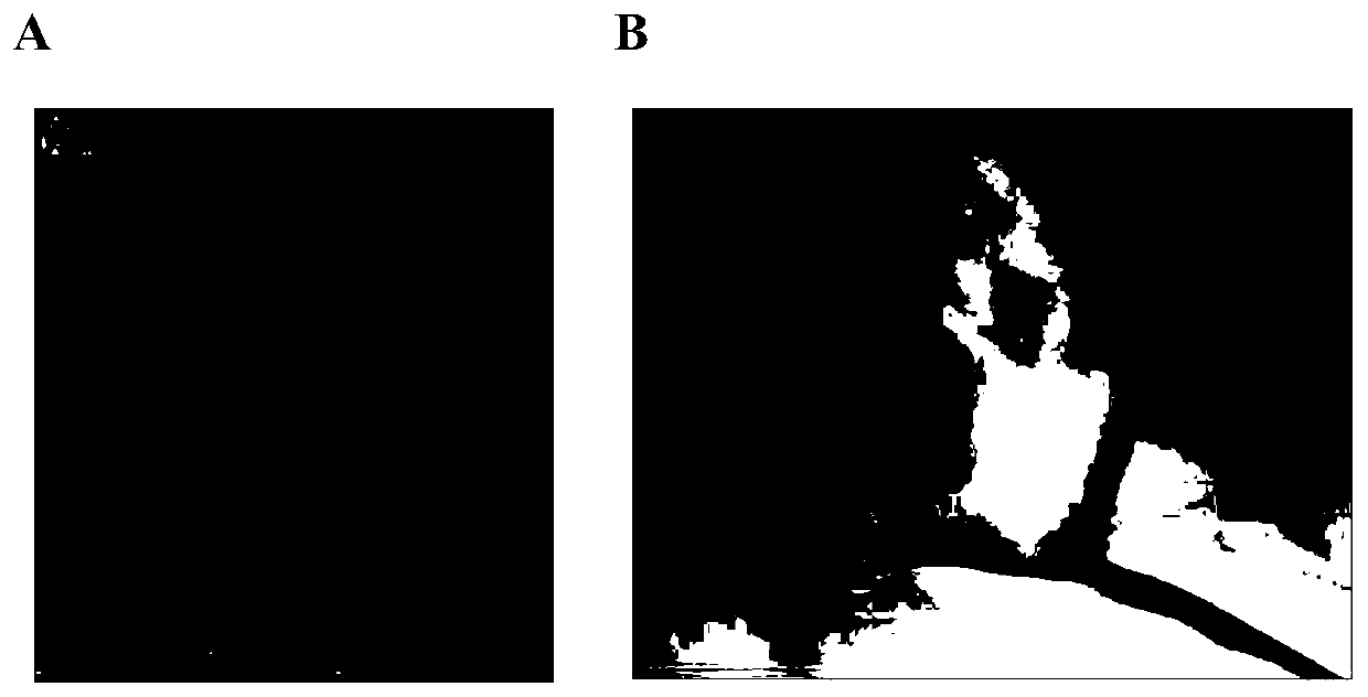 Establishment method of cerebral-palsy-based temporal lobe epilepsy animal model