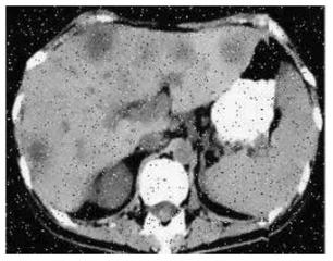 A medical image segmentation method for liver model in robot virtual training system